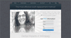 Desktop Screenshot of mydentalimplants.ca