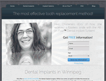 Tablet Screenshot of mydentalimplants.ca